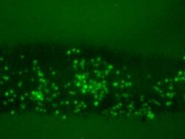 Immobilisierung von Hefezellen: Fluoreszenzmikroskopie